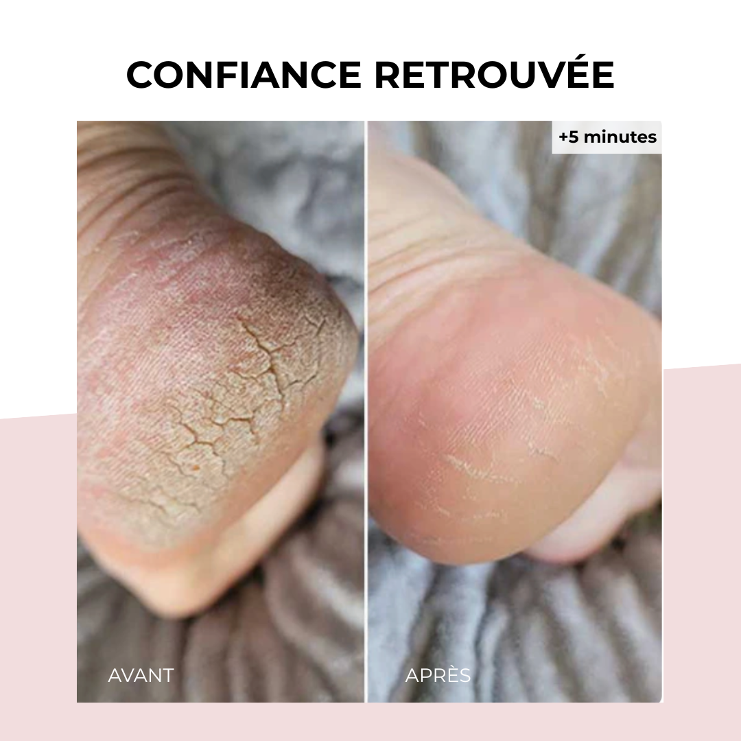 Livencare L7-C PRO - Râpe pied électrique